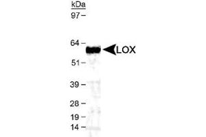 Western blot analysis of LOX in mouse kidney lysate using LOX polyclonal antibody  (1 : 1,000). (LOX 抗体  (AA 200-300, AA 300-400))