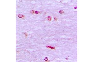 Immunohistochemical analysis of BRF1 staining in human brain formalin fixed paraffin embedded tissue section. (BRF1 抗体  (Center))