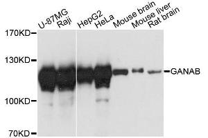 Western blot analysis of extracts of various cell lines, using GANAB antibody. (GANAB 抗体  (AA 1-260))