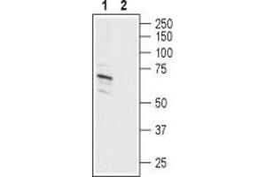 Western blot analysis of human SH-SY5Y neuroblastoma cell line lysate: - 1. (ASIC1 抗体  (C-Term, Intracellular))
