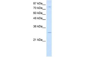 RBM28 antibody used at 0. (RBM28 抗体  (C-Term))