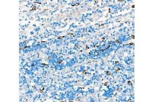 IHC analysis of CD68 using anti-CD68 antibody (ABIN7600142).
