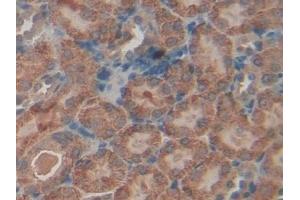 Immunohistochemistry (IHC) image for anti-Transforming Growth Factor, beta-Induced, 68kDa (TGFBI) (AA 423-632) antibody (ABIN7431152)