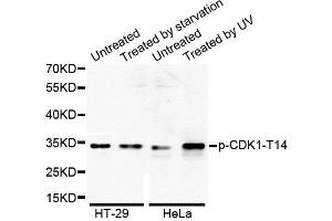 Western Blotting (WB) image for anti-Cyclin-Dependent Kinase 1 (CDK1) (pThr14) antibody (ABIN1870047) (CDK1 抗体  (pThr14))
