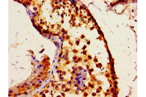 Immunohistochemistry of paraffin-embedded human testis tissue using ABIN7156293 at dilution of 1:100 (ITPR1 抗体  (AA 1707-1966))