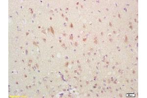 Formalin-fixed and paraffin embedded rat brain labeled with Anti-GADD45 Polyclonal Antibody, Unconjugated (ABIN685432) followed by conjugation to the secondary antibody and DAB staining (GADD45A 抗体  (AA 65-165))