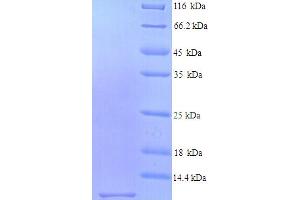 SDS-PAGE (SDS) image for Stimulator of Chondrogenesis 1 (SCRG1) (AA 21-98) protein (His tag) (ABIN4974927) (SCRG1 Protein (AA 21-98) (His tag))