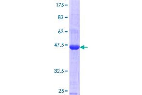 MAGEC1 Protein (AA 1-139) (GST tag)