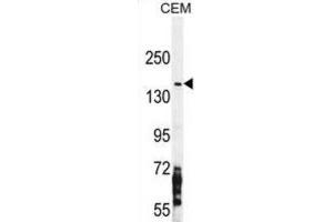 Western Blotting (WB) image for anti-Nitric Oxide Synthase 2, Inducible (NOS2) antibody (ABIN5978580)