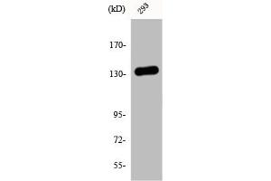 Western Blot analysis of 293 cells using DGK-ι Polyclonal Antibody (DGKI 抗体  (C-Term))
