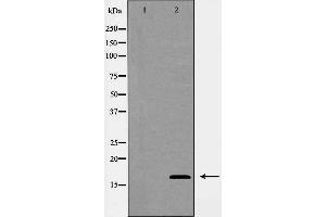 Western blot analysis of COX IV expression in Jurkat cells. (COX IV 抗体  (Internal Region))