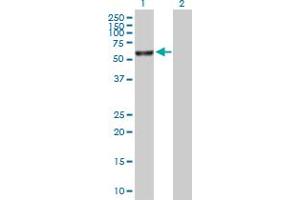 Western Blot analysis of FANCE expression in transfected 293T cell line by FANCE MaxPab polyclonal antibody. (FANCE 抗体  (AA 1-536))