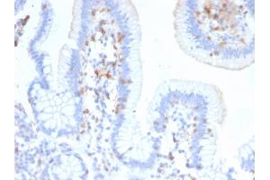 Formalin-fixed, paraffin-embedded human Small Intestine stained with CD103 Mouse Monoclonal Antibody (ITGAE/2474).
