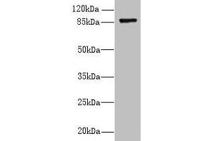 Western blot All lanes: FSCB antibody at 1. (FSCB 抗体  (AA 1-200))