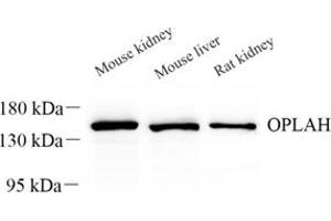 Western blot analysis of OPLAH (ABIN7072860) at dilution of 1: 500 (OPLAH 抗体)