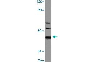 Western blot analysis of A-549 cell lysate with AGTR1 polyclonal antibody  at 1:500 dilution. (Angiotensin II Type-1 Receptor 抗体  (AA 150-200))