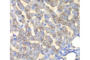 Immunohistochemistry of paraffin-embedded Rat liver using FAH Polyclonal Antibody at dilution of 1:100 (40x lens). (FAH 抗体)