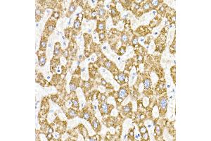Immunohistochemistry of paraffin-embedded human liver using  Rabbit mAb (ABIN7265363) at dilution of 1:25 (40x lens). (ACAT1 抗体)