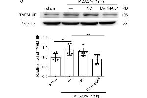 LV-TMEM16F-RNAi transfection downregulates TMEM16F in rat brain. (Anoctamin 6 抗体  (AA 744-824))