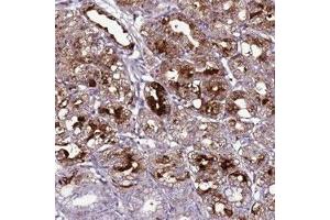 Immunohistochemical staining of human stomach, lower with C19orf47 polyclonal antibody  shows strong cytoplasmic positivity in glandular cells at 1:50-1:200 dilution. (C19orf47 抗体)