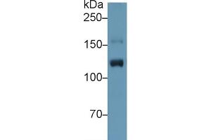 Western Blot; Sample: Human Placenta lysate; Primary Ab: 1µg/ml Rabbit Anti-Human ITIH4 Antibody Second Ab: 0. (ITIH4 抗体  (AA 29-157))