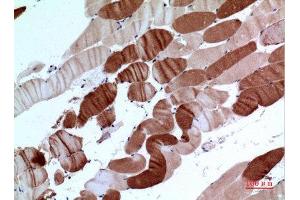 Immunohistochemistry (IHC) image for anti-ATPase, Ca++ Transporting, Cardiac Muscle, Slow Twitch 2 (ATP2A2) (C-Term) antibody (ABIN3187946)
