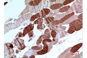 Immunohistochemistry (IHC) analysis of paraffin-embedded Human Muscle, antibody was diluted at 1:100. (ATP2A2 抗体  (C-Term))