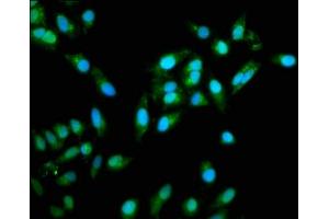 Immunofluorescence staining of Hela cells with ABIN7172247 at 1:333, counter-stained with DAPI. (TRAF6 抗体  (AA 1-522))