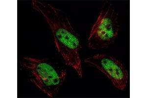Fluorescent image of HeLa cells stained with SUMO antibody at 1:25. (SUMO1 抗体  (AA 52-79))