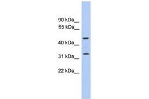 Image no. 1 for anti-Tumor Protein P63 Regulated 1 (TPRG1) (C-Term) antibody (ABIN6746427) (TPRG1 抗体  (C-Term))