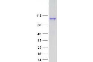 Western Blotting (WB) image for Amyloid beta (A4) Precursor Protein-Binding, Family B, Member 1 Interacting Protein (APBB1IP) protein (Myc-DYKDDDDK Tag) (ABIN2714777)