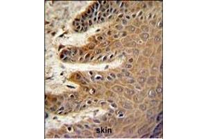 Immunohistochemistry (Paraffin-embedded Sections) (IHC (p)) image for anti-Cell Division Cycle 37 Homolog (S. Cerevisiae) (CDC37) (AA 116-144) antibody (ABIN652914)