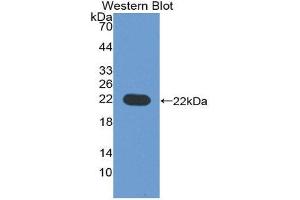 Western Blotting (WB) image for anti-CD276 (CD276) (AA 47-219) antibody (ABIN1867121) (CD276 抗体  (AA 47-219))