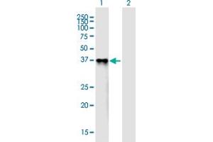 Western Blot analysis of PROL1 expression in transfected 293T cell line ( H00058503-T01 ) by PROL1 MaxPab polyclonal antibody. (PROL1 抗体  (AA 1-248))