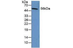 Figure. (Fibrinogen beta Chain 抗体  (AA 29-118))