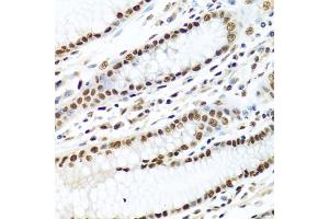 Immunohistochemistry of paraffin-embedded human stomach using METTL3 antibody (ABIN5974672) at dilution of 1/100 (40x lens). (METTL3 抗体)