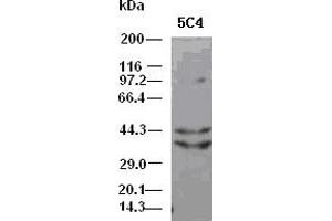 DFF45 antibody (5C4) at 1:5000 dilution + Hela cell lysate (DFFA 抗体)