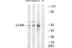 Western blot analysis of extracts from Jurkat/HepG2/LOVO cells, using LYAR Antibody. (LYAR 抗体  (AA 241-290))