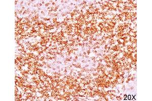 IHC testing of human tonsil (10X) stained with CD6 antibody (C6/372). (CD6 抗体)