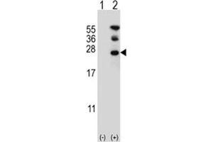 Western blot analysis of RAN antibody and 293 cell lysate either nontransfected (Lane 1) or transiently transfected (2) with the RAN gene. (RAN 抗体  (AA 12-39))