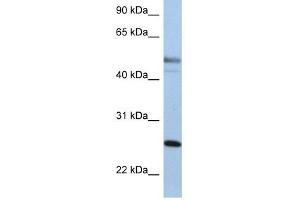 Cytokeratin 8 antibody used at 1 ug/ml to detect target protein. (KRT8 抗体  (Middle Region))