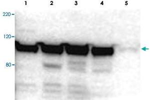 Western blot using MYO1G polyclonal antibody  shows detection of a band ~100 kDa in size corresponding to MYO1G (arrowhead) in MYO1G positive whole cell lysate. (MYO1G 抗体  (Internal Region))