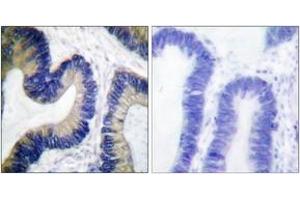 Immunohistochemistry (IHC) image for anti-Eukaryotic Translation Initiation Factor 4E Binding Protein 1 (EIF4EBP1) (AA 30-79), (pSer64) antibody (ABIN1531250)