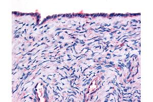 Anti-THRA antibody IHC of human surface epithelium. (THRA 抗体  (Ligand Binding Domain))