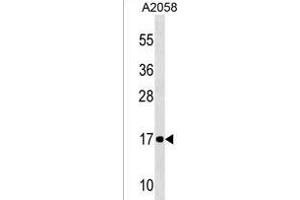 NDUFA12 Antibody (C-term) (ABIN1536636 and ABIN2850177) western blot analysis in  cell line lysates (35 μg/lane). (NDUFA12 抗体  (C-Term))