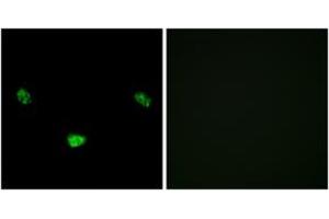 Immunofluorescence analysis of LOVO cells, using HNF4 alpha (Phospho-Ser313) Antibody. (HNF4A 抗体  (pSer313))