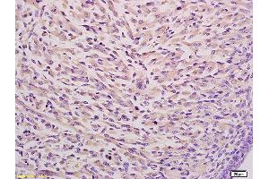 Formalin-fixed and paraffin embedded mouse embryo tissue labeled with Anti CKAP4 Polyclonal Antibody,Unconjugated (ABIN717506) at 1:200 followed by conjugation to the secondary antibody and DAB staining. (CKAP4 抗体  (AA 525-602))
