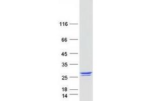 Western Blotting (WB) image for RAN Guanine Nucleotide Release Factor (RANGRF) protein (Myc-DYKDDDDK Tag) (ABIN2730463)