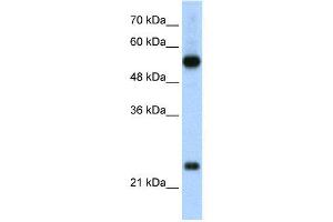 WB Suggested Anti-RPL13  Antibody Titration: 2. (RPL13 抗体  (C-Term))
