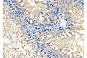 ABIN6264759 and ABIN6278629 at 1/100 staining Rat testis tissue by IHC-P. (RIOK3 抗体  (Internal Region))